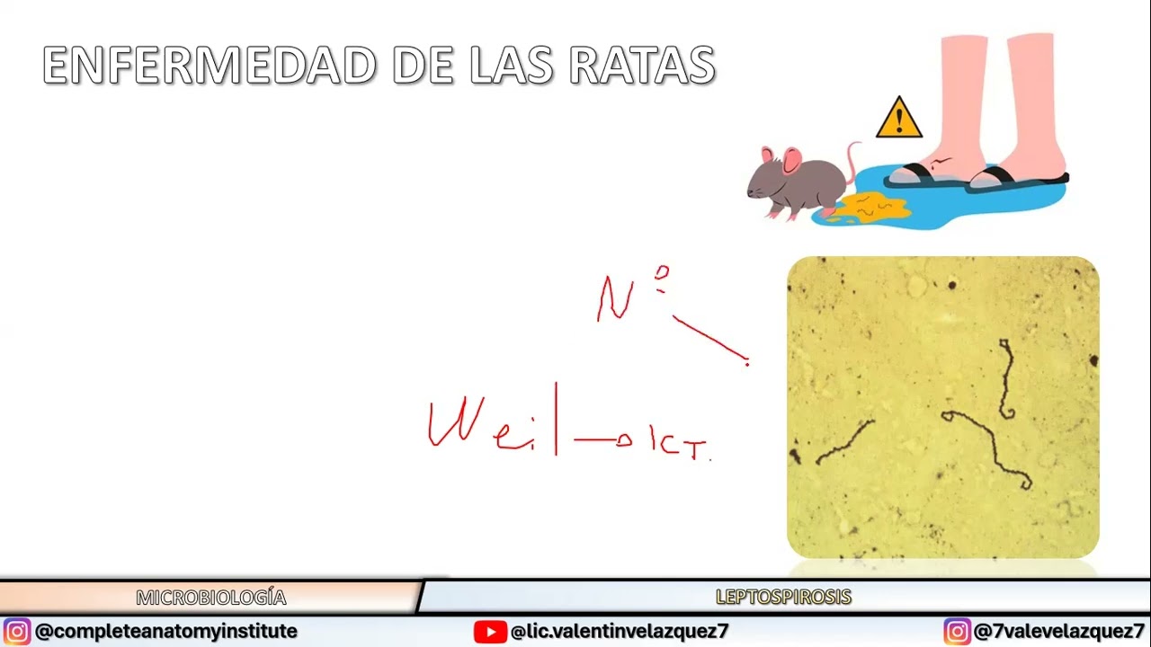 Enfermedad de las ratas | Leptospirosis | Leptospira interrogans y biflexa