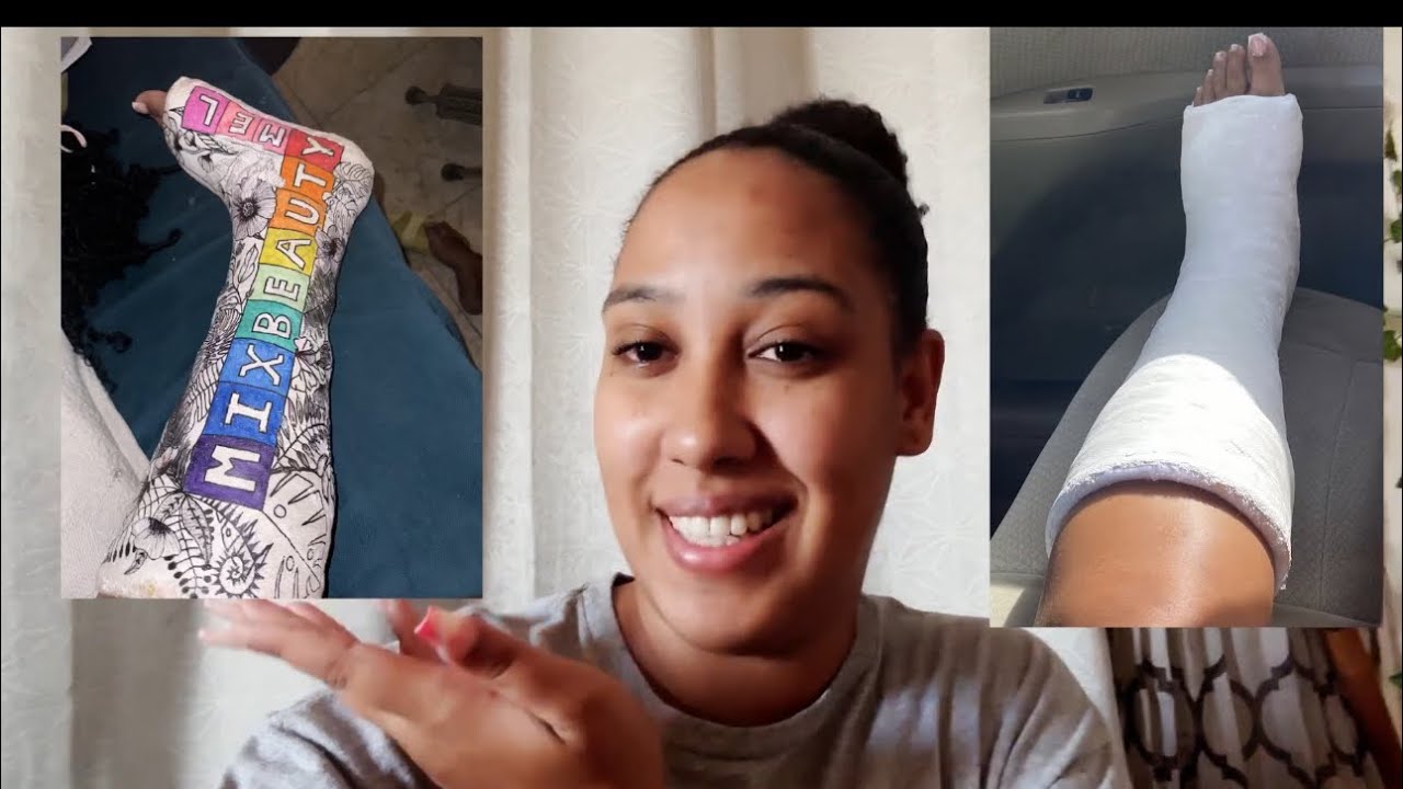 I got bored at home with my broken leg and decided to paint my cast