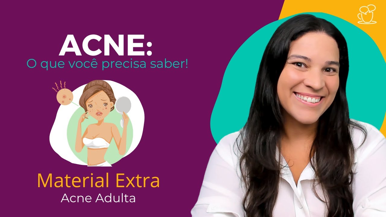 Acne Adulta
