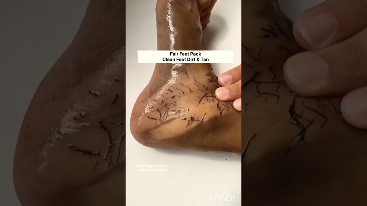 ✨✅facepack for glowing skin homemade / hand & feet tan removal at home#shorts #beautytips #skincare