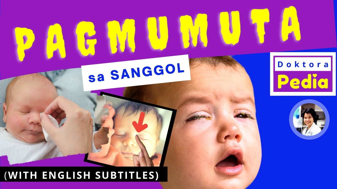 PAGMUMUTA sa SANGGOL  | NAGMUMUTA ang mga MATA ni BABY | DOKTORA PEDIA