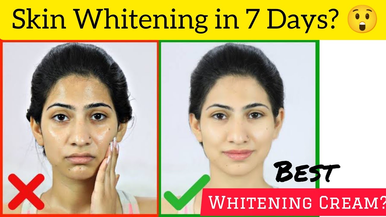 Best Skin Whitening Cream for Glowing & Even Skin | Budget-Friendly & Effective #skinwhitening
