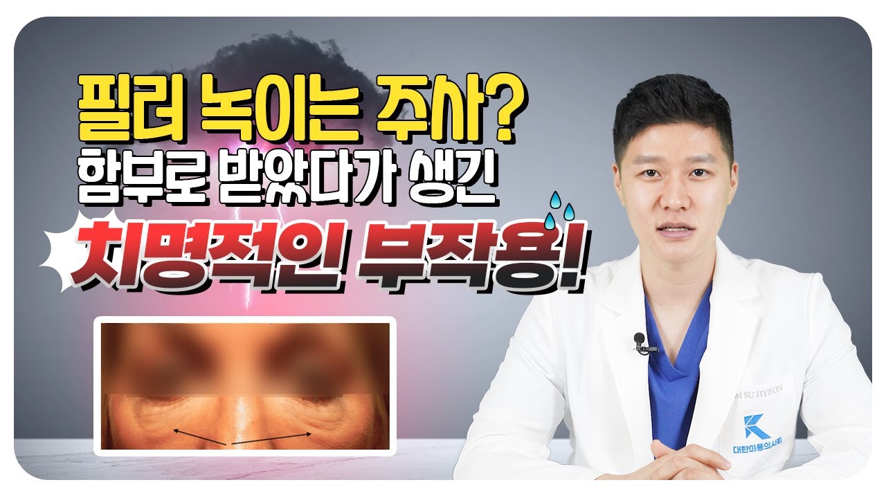 필러 녹이는 주사 함부로 받지 마세요!! (ft. 히알라제 부작용)