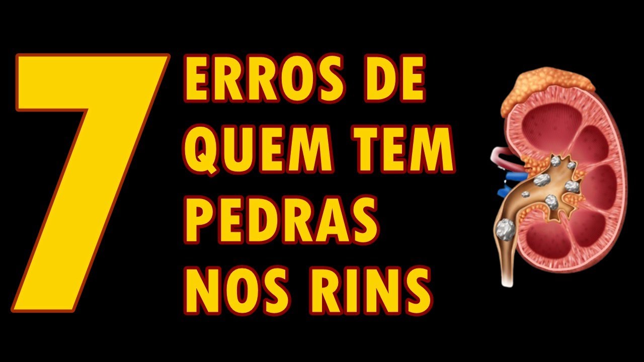 7 HÁBITOS que PIORAM os CÁLCULOS RENAIS