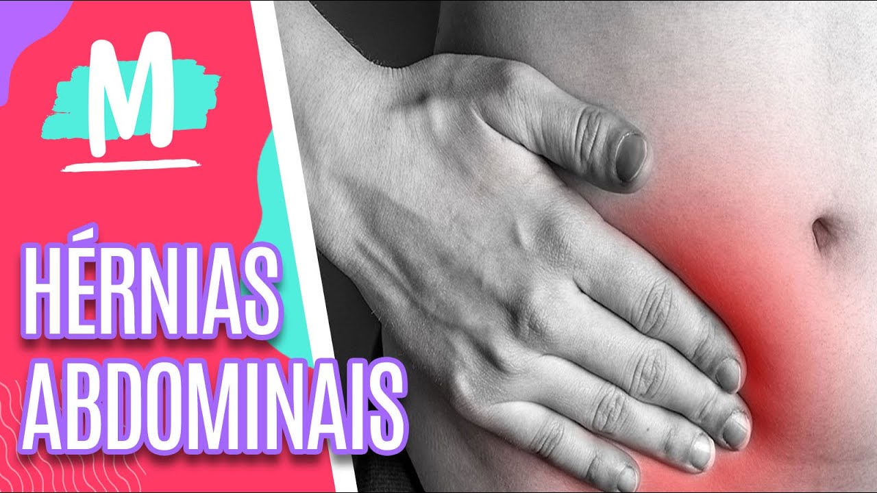 Mitos e verdades sobre hérnias abdominais - Mulheres (02/08/2021)
