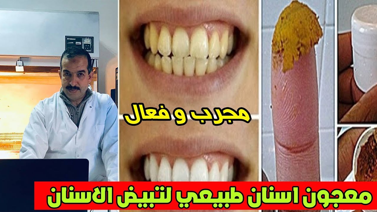 لن تلجأ لطبيب الأسنان لتبييض الأسنان ولا لإزالة الجير سيسقط وحده بعد استعمالك لهدا المعجون الطبيعي
