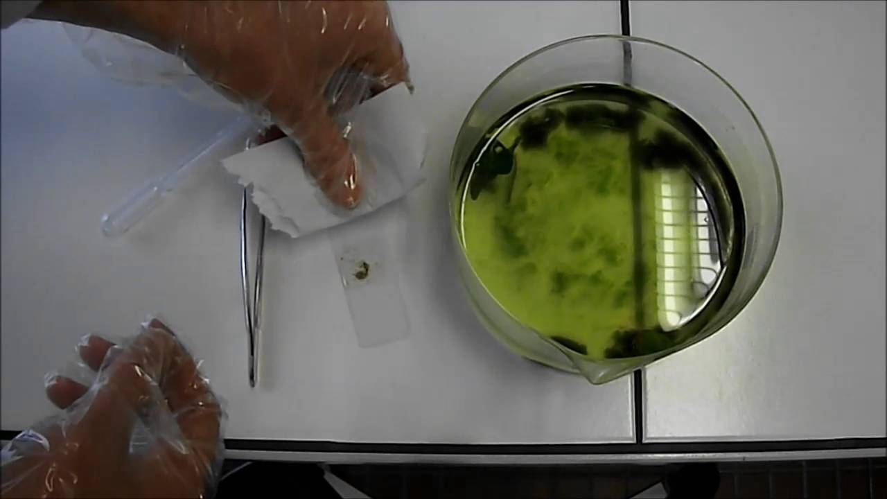micro-organismes des eaux stagnantes