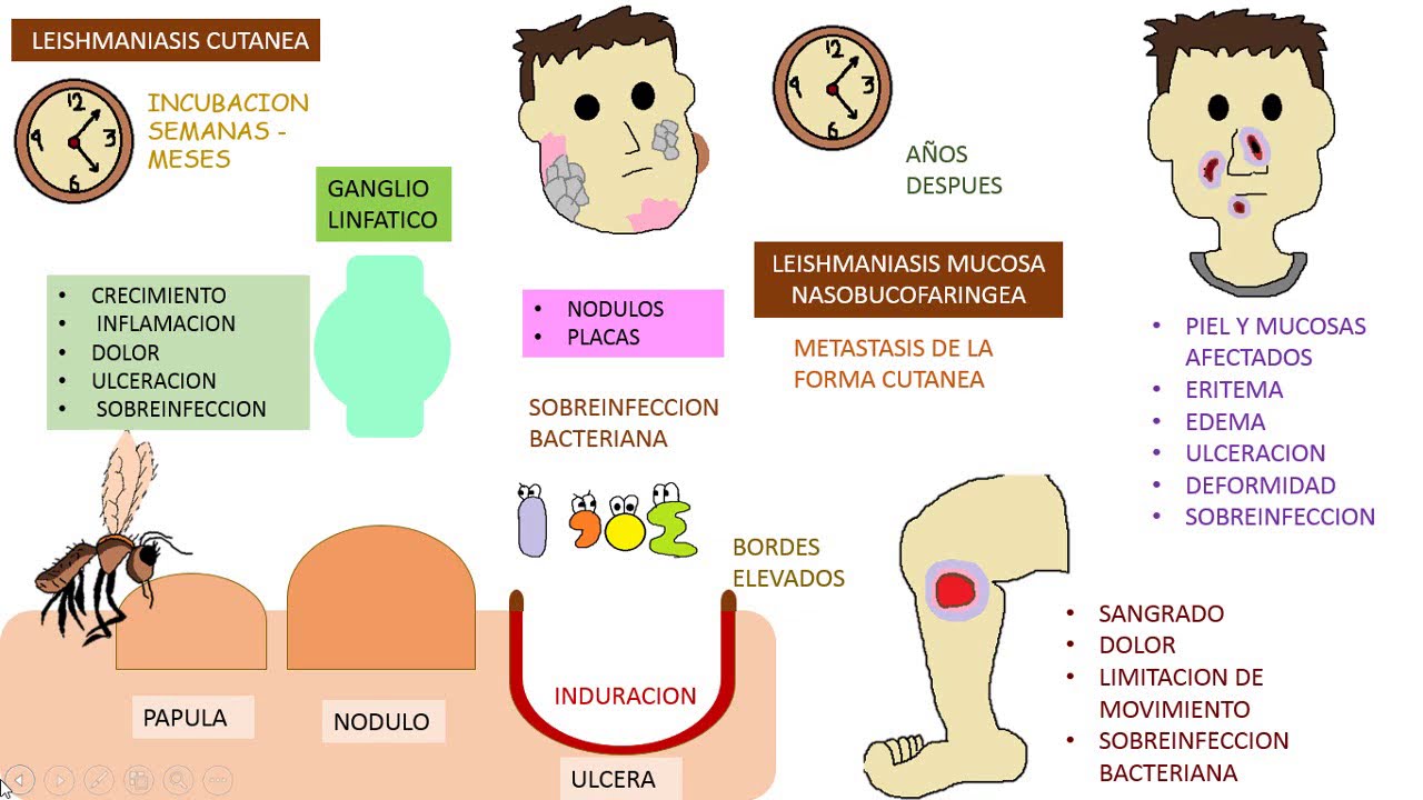 Leishmania
