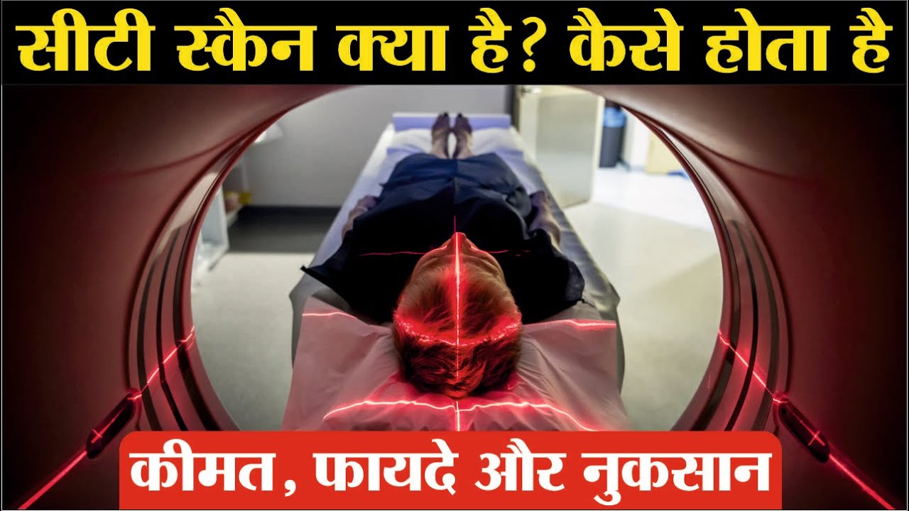 CT Scan Kaise Hota Hai | ct scan cost | ct scan machine