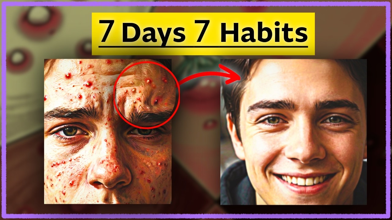 7 Days, 7 Habits to Reduce Acne.