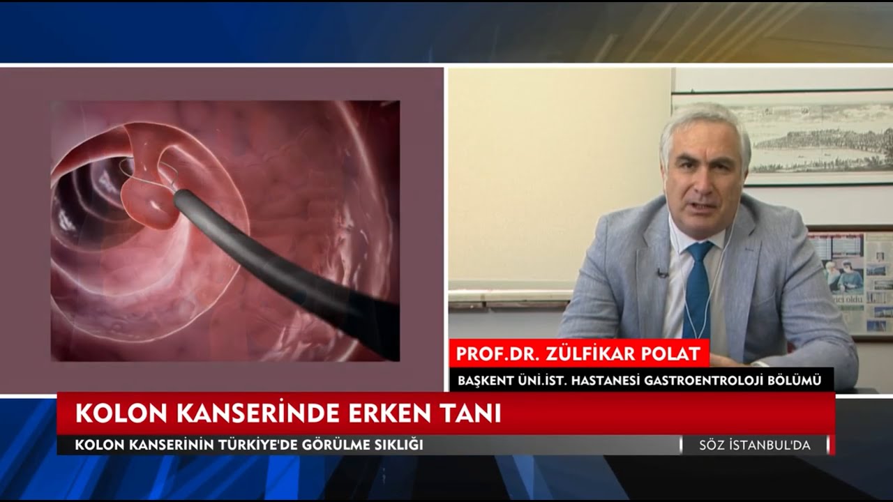 Kolon Kanserinde Erken Tanı ve Tarama Süreci