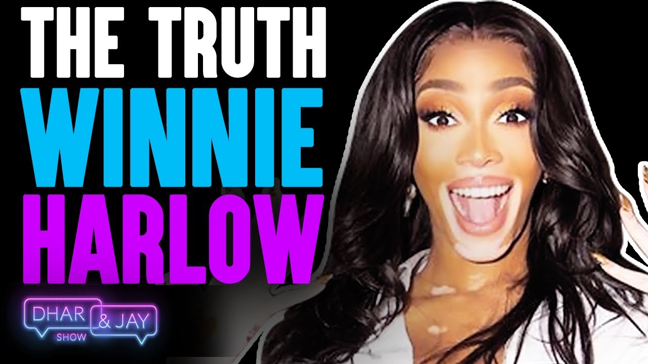 Winnie Harlow On Shooting With Beyoncé and Finding Confidence | Dhar and Jay Podcast Show