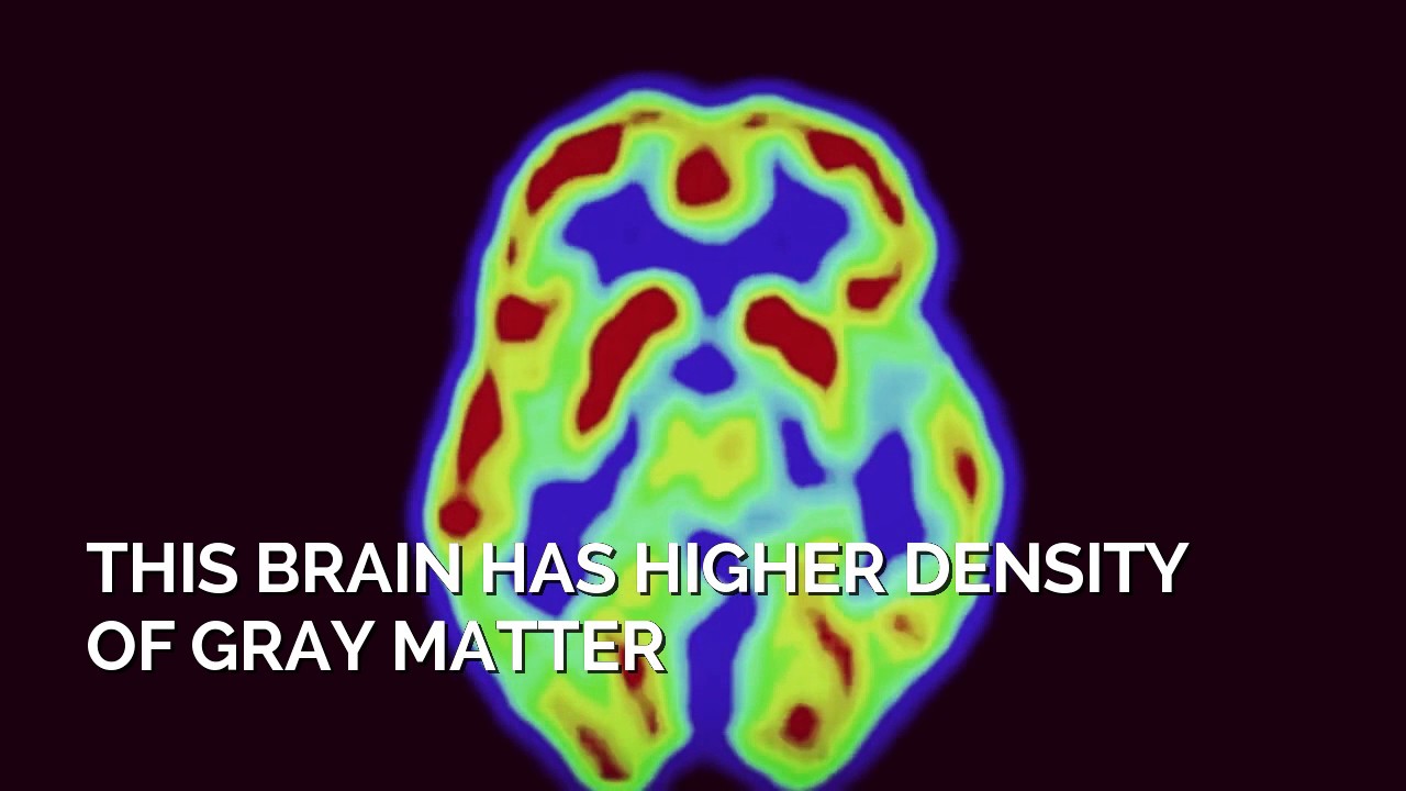 Bilingual brain