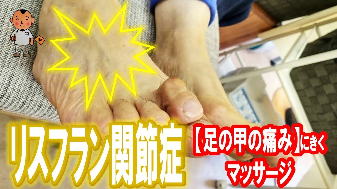 【リスフラン関節症】足の甲の痛みのマッサージ方法【川崎市の外反母趾治療家 バイタルあきやま】