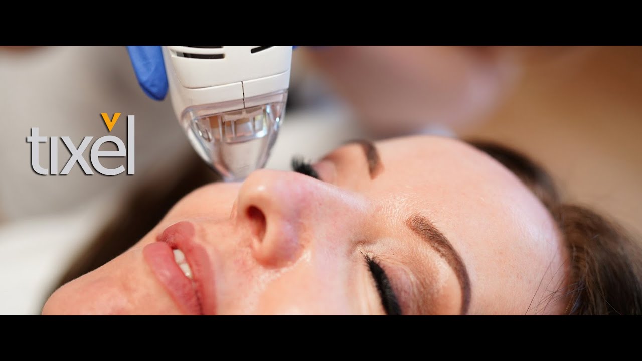 Tixel Skin Resurfacing