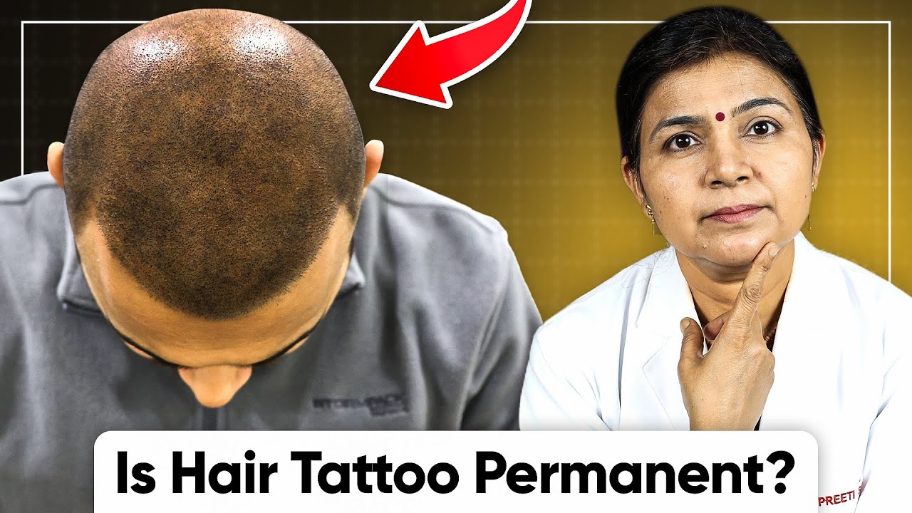 Is Scalp Micropigmentation Permanent? - Life of Scalp Tattoo for Hair Loss #SMP