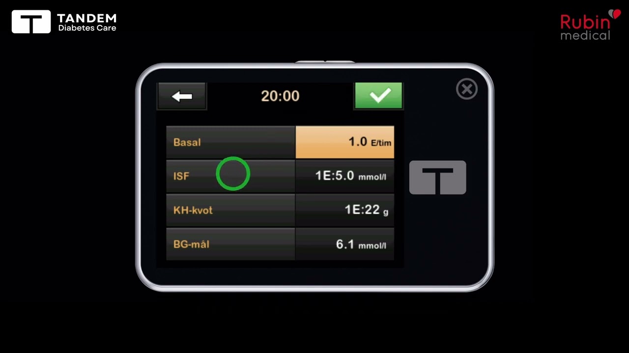 Skapa ny personlig profil i din Tandem t:slim X2 insulinpump