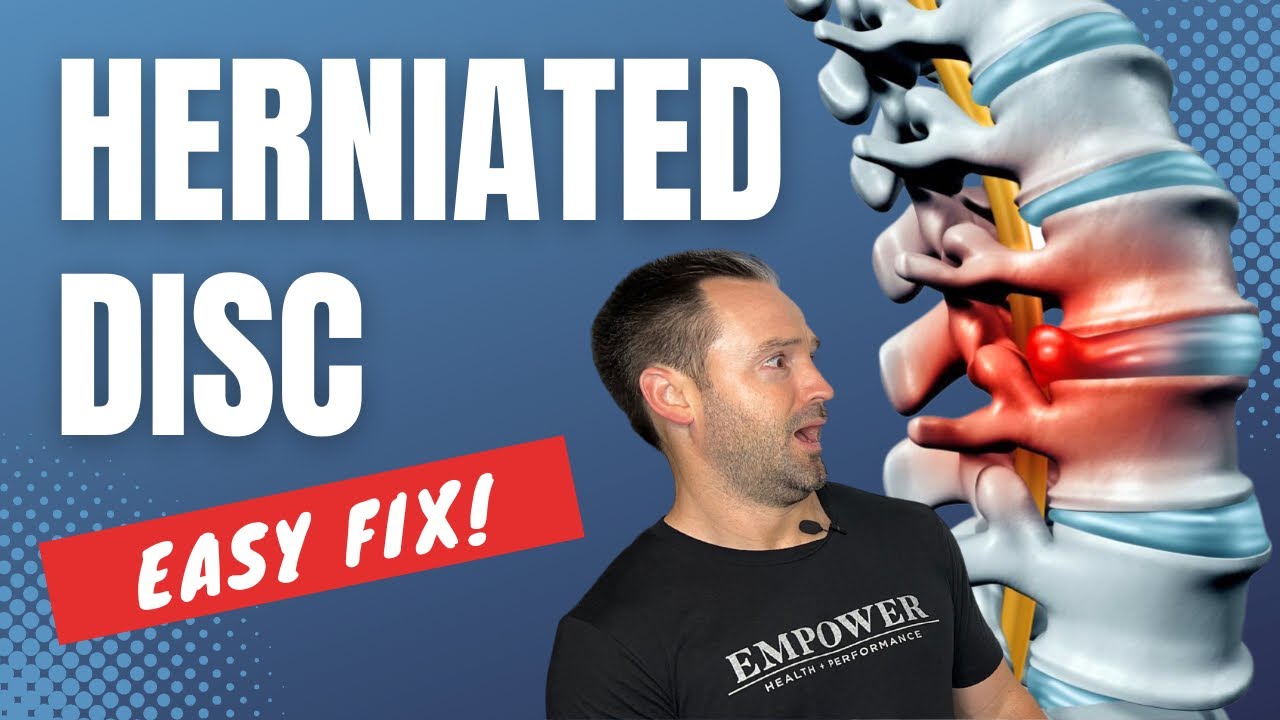 How to fix a Herniated Disc!