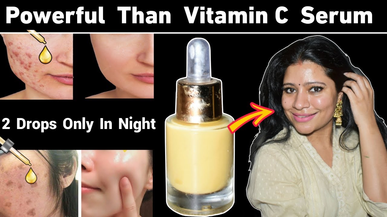 Use Only Few Drops In Night To Remove Scars,pigmentation,Pimples,Acne बस दो बूँद और साफ निखरी Skin.