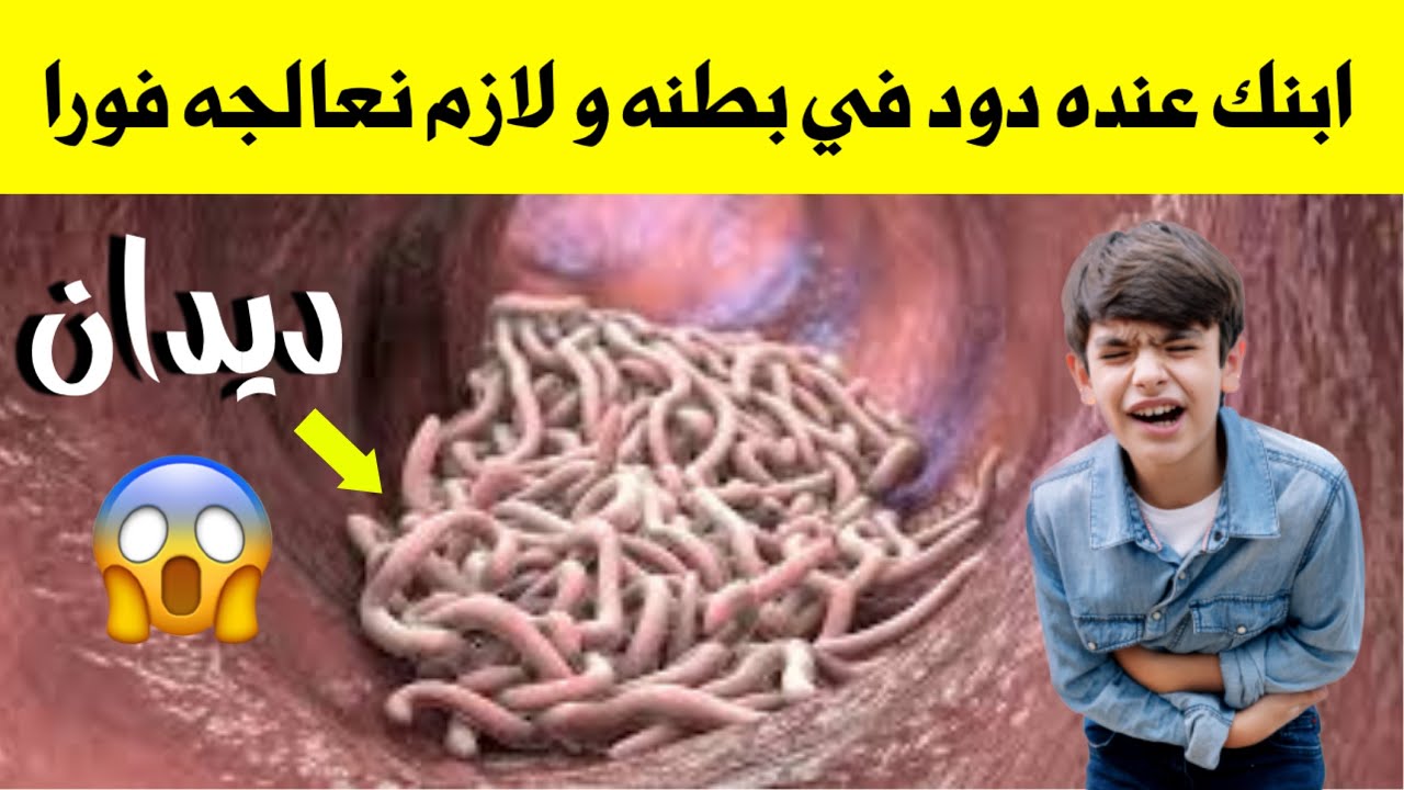 اعراض الديدان عند الاطفال و الرضع و علاج الديدان عند الاطفال نهائيا في يوم واحد فقط