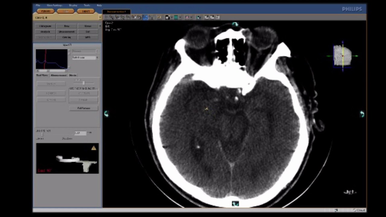 Case-2, ICAD, 04-03-2026