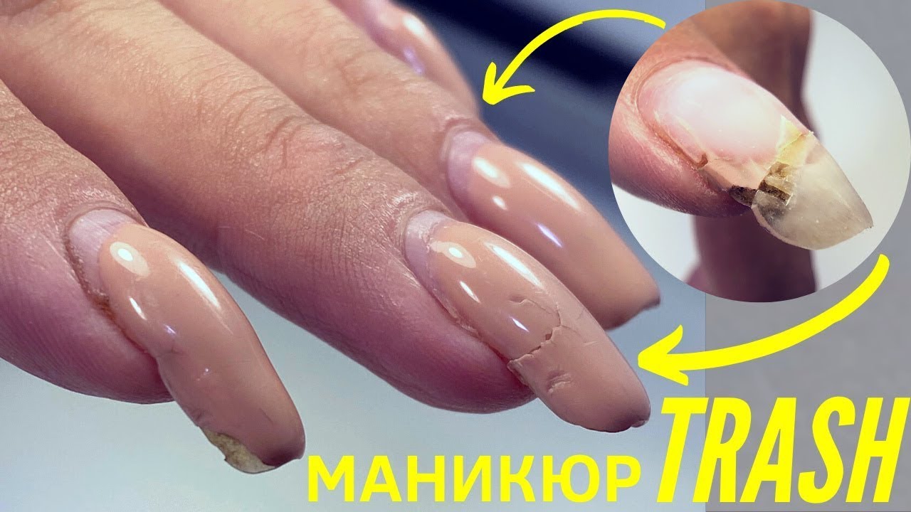 Отслойки, трещины и грязь. Покрытие гель лак и дизайн ногтей 2022