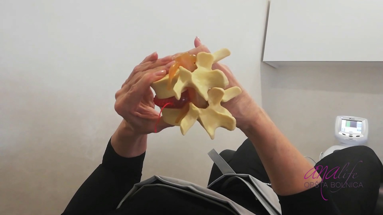 Kako da neoperativno rešim problem išijasa - diskushernije