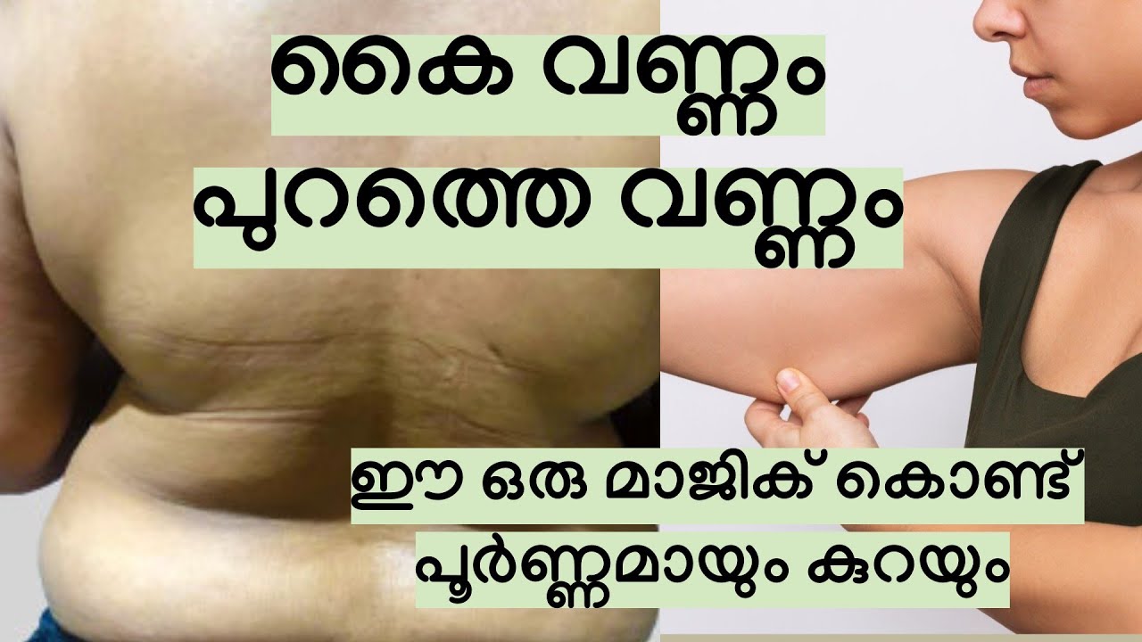 കൈവണ്ണം പുറത്തെ വണ്ണം  ഈ മാജിക്‌ കൊണ്ട് പൂർണ്ണമായും ഇല്ലാതാക്കാം..|| Weightloss Malayalam