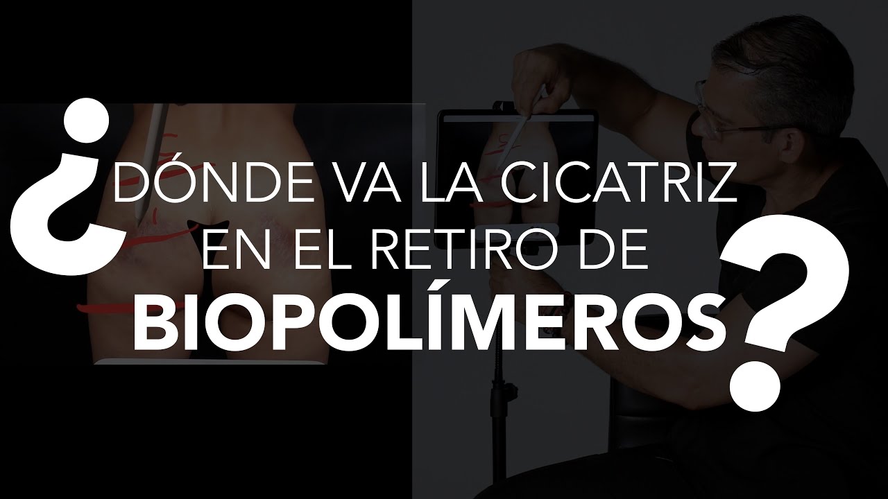 Dónde va  ubicadas la Incisión o cicatriz en el retiro de biopolímeros