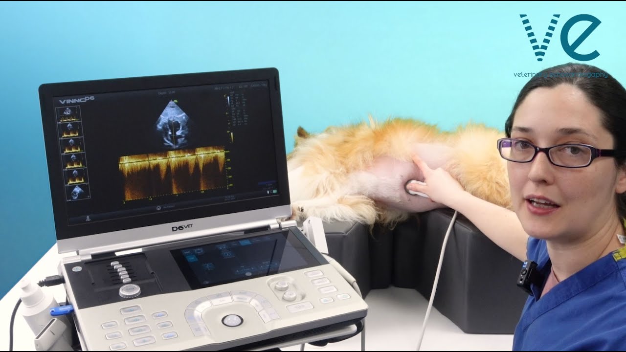 Perfecting your alignment for the subcostal view