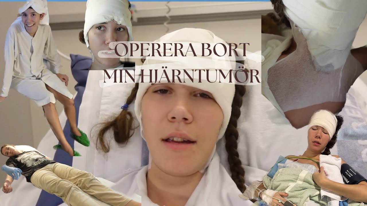 Jag opererar bort min HJÄRNTUMÖR!