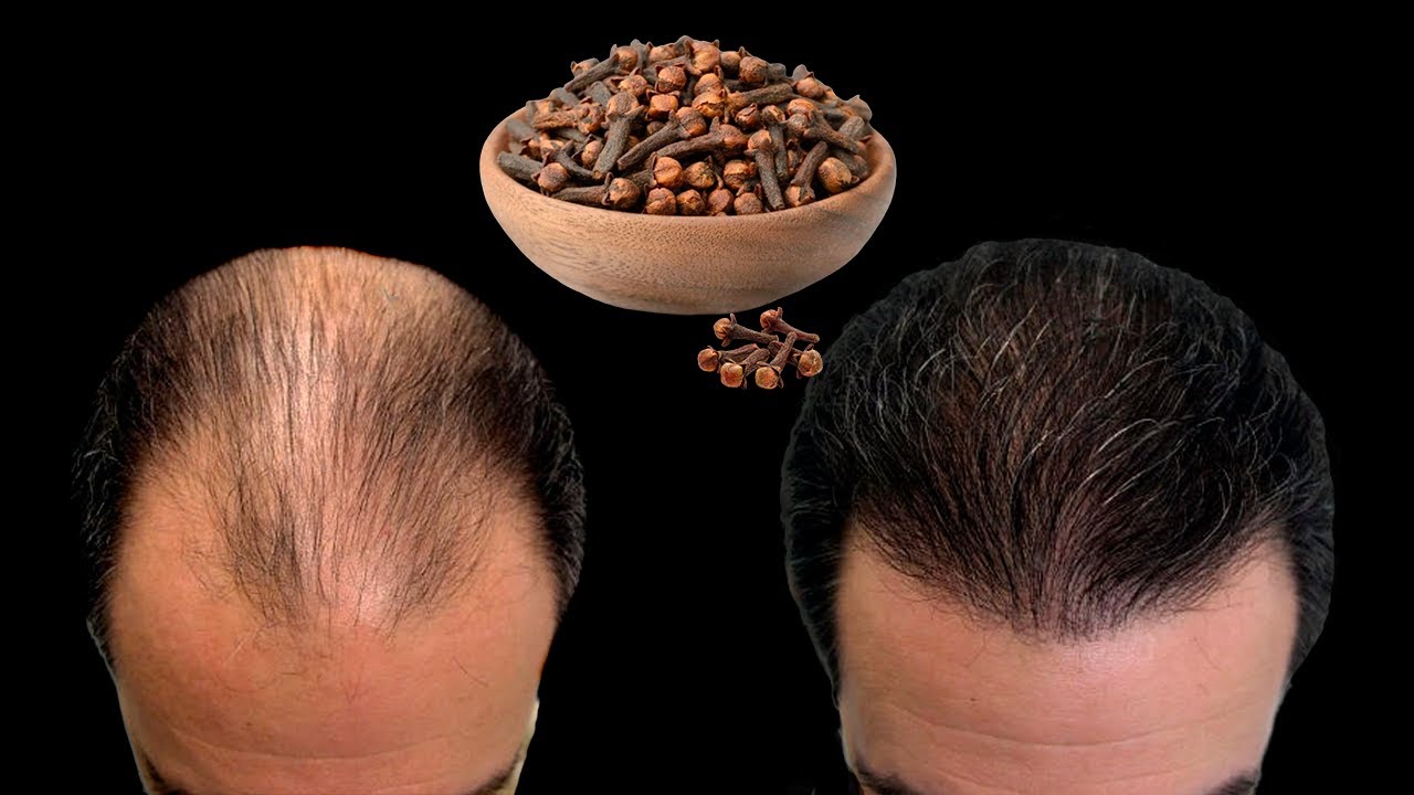 Haare wachsen schnell und fallen nicht aus – Rosmarin für Haarwachstum! Das ist das beste Mittel