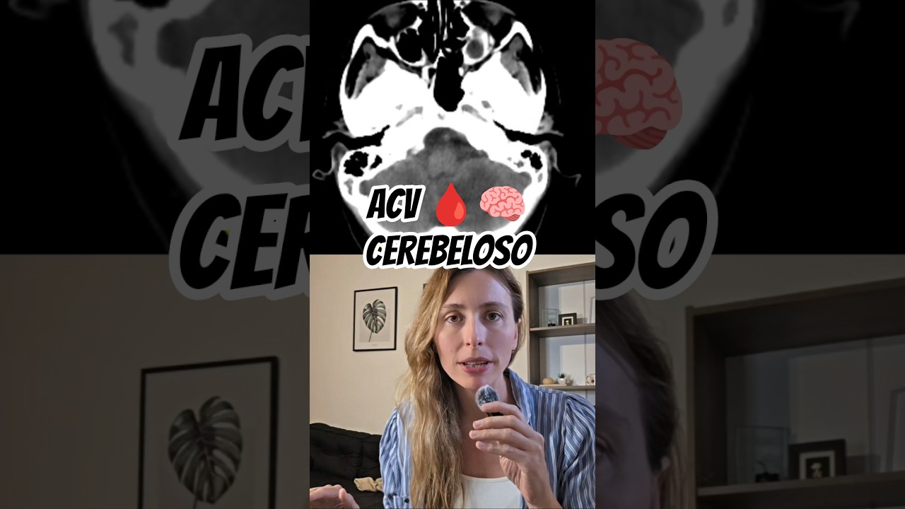 Parte 2/5 patología de fosa posterior en 