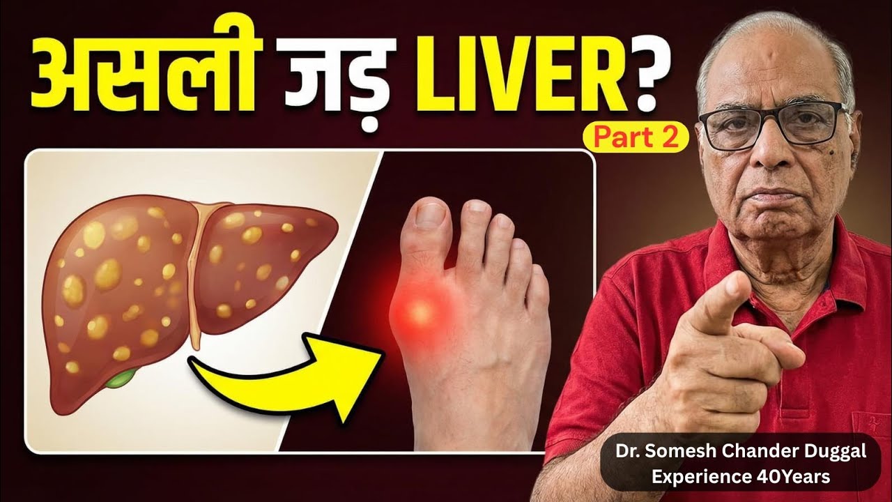 Gout and Uric Acid का पक्का ईलाज। Time Tested Formula | लीवर को ठीक करो पहले।@someshduggal।