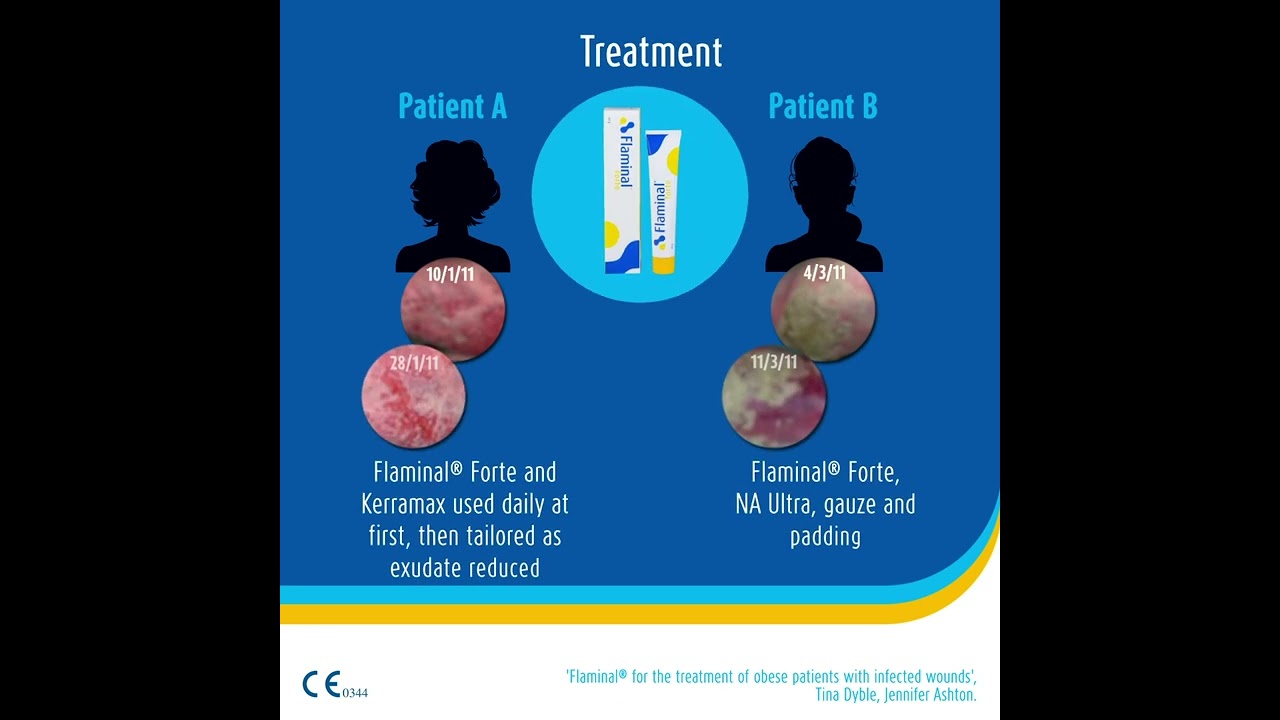Case study - Leg Ulcer