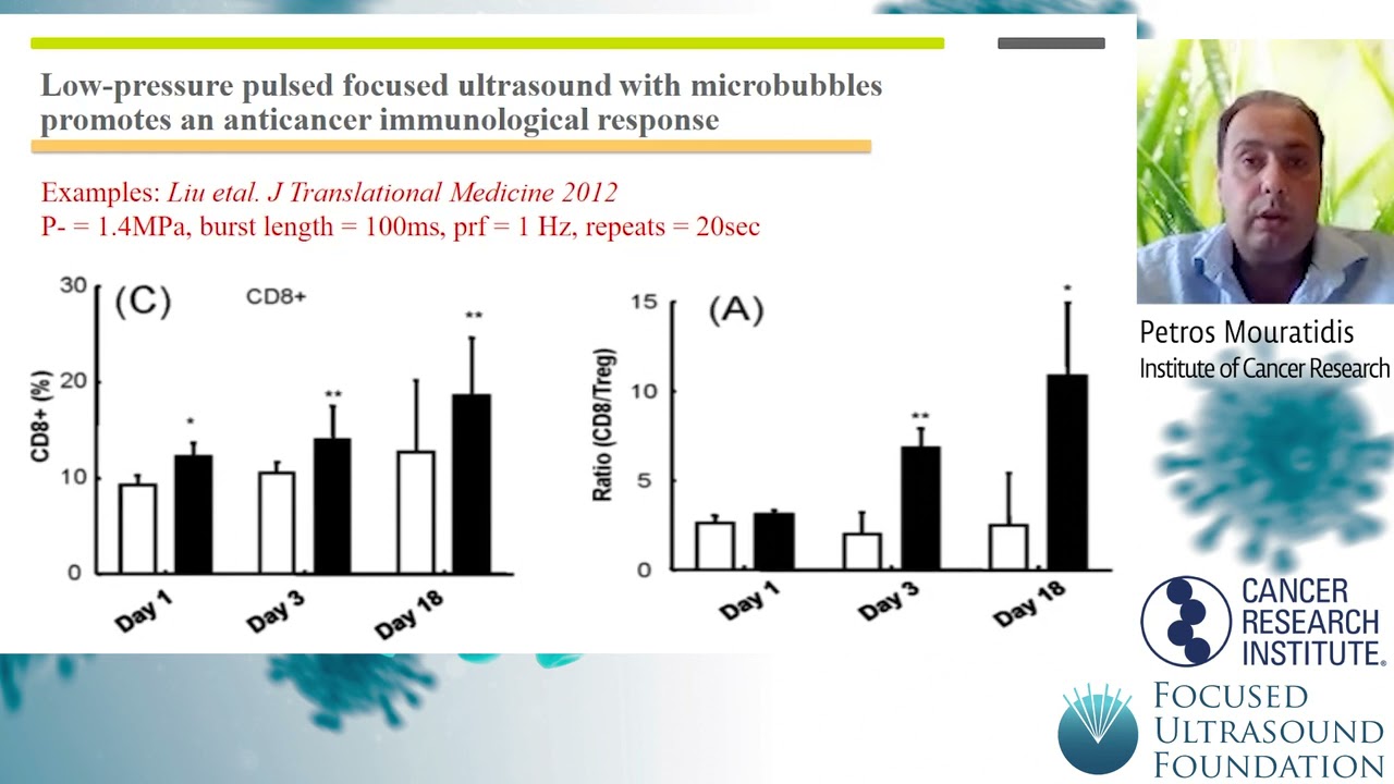Cancer Immunotherapy Workshop 2021 &ndash; Low Intensity Focused Ultrasound's Effect on Immune Response