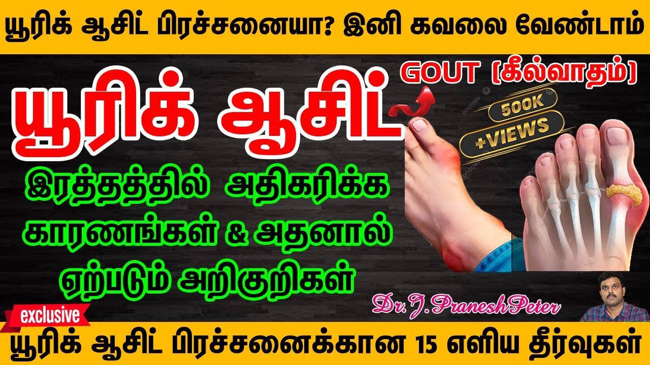 URIC ACID | GOUT | யூரிக் ஆசிட் அதிகரிக்க காரணங்கள் அறிகுறிகள்&குணப்படுத்தும் வீட்டு வைத்திய முறைகள்