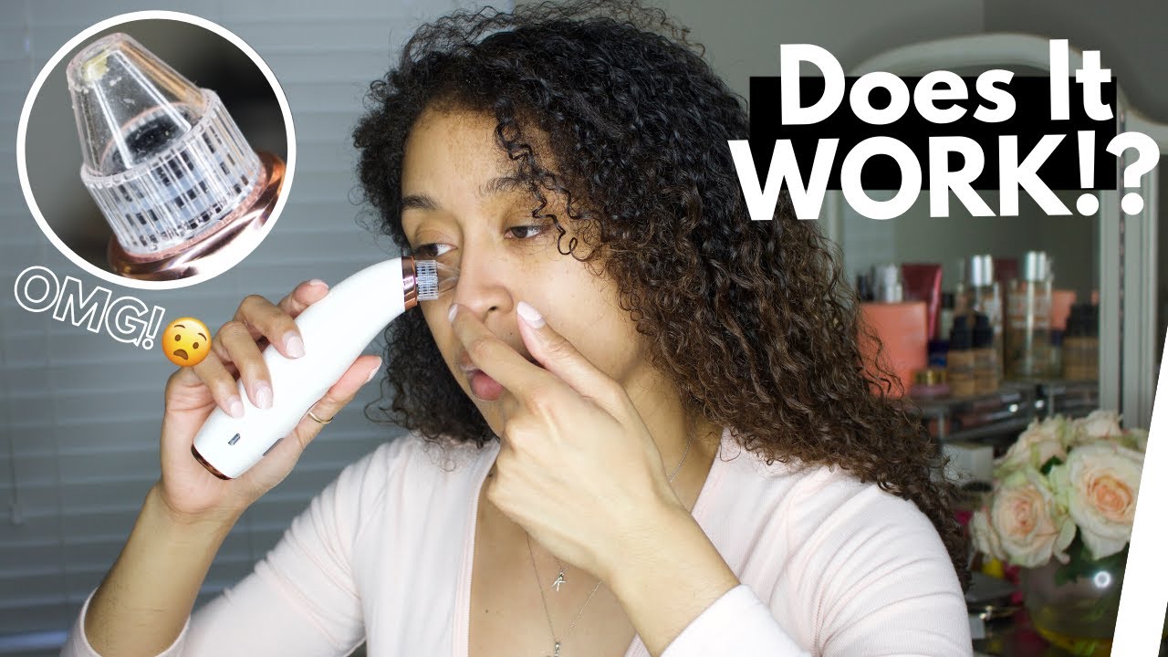 I TRIED USING A BLACKHEAD REMOVER PORE VACUUM.. THIS IS WHAT HAPPENED | FIRST IMPRESSION + DEMO
