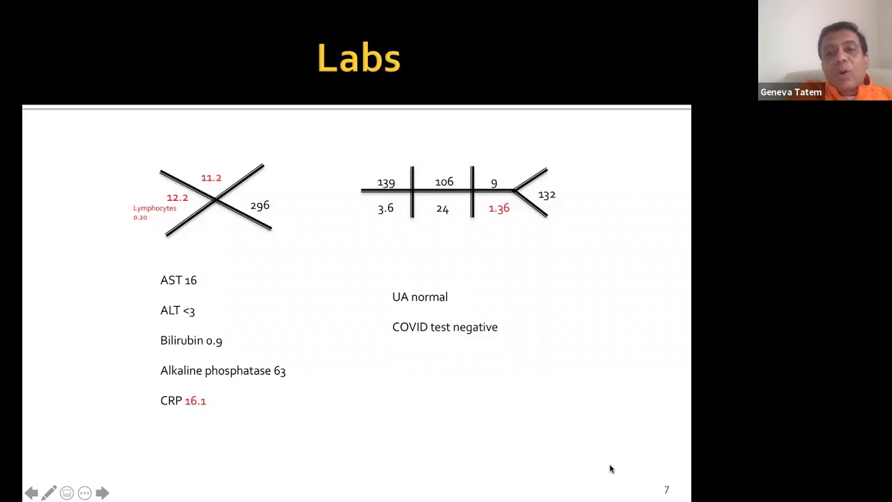 11/6/20 Pulmonary infections in the immunocompromised patient - Dr Ramesh