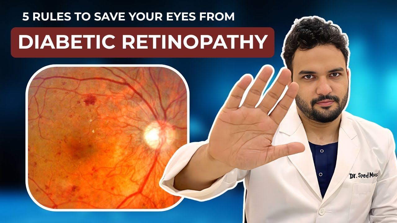 5 Rules Every Diabetic Must Follow to Save Their Vision | Tamil | Dr. Syed Moosa | Eye Doctor |