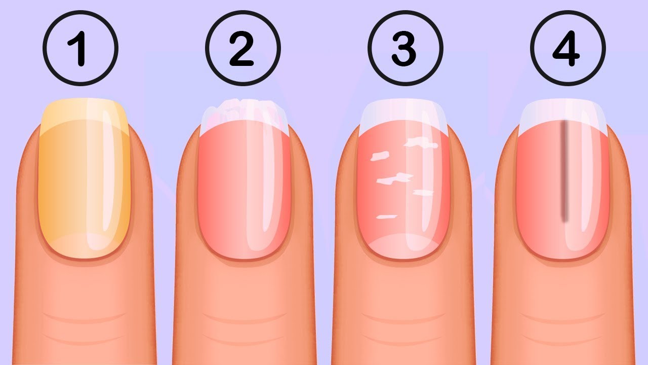 5 Things Your Nails Can Tell You About Your Health