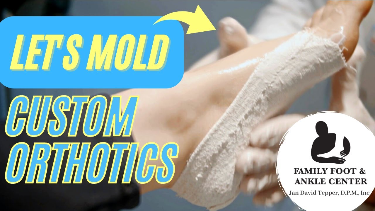 Custom Orthotic Casting: California Podiatrist