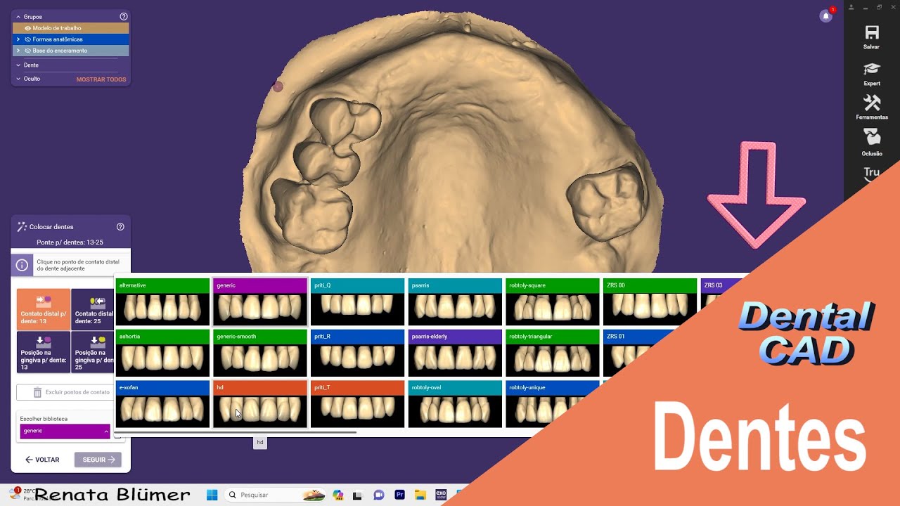 PPR DIGITAL - EXOCAD PARTIAL CAD - CURSO PPR DIGITAL HOTMART Renata Blumer  - DENTES