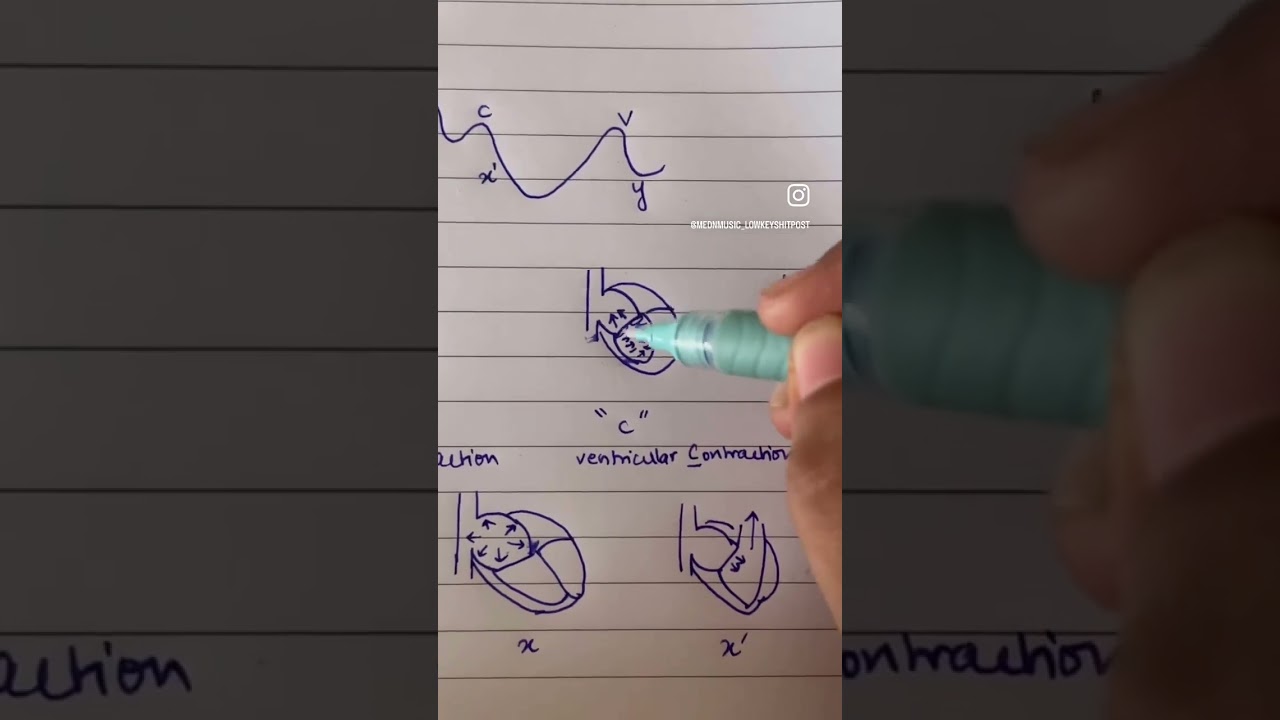 Jugular Venous Pressure (JVP) explained
