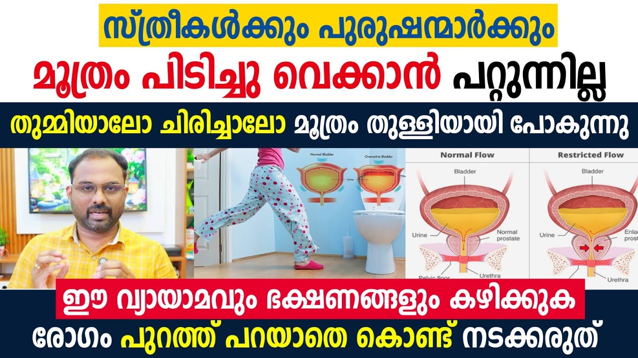 മൂത്രം പിടിച്ചു വെക്കാൻ പറ്റുന്നില്ല ; തുമ്മിയാലോ ചിരിച്ചാലോ മൂത്രം തുള്ളിയായി പോകുന്നു ; ഇത് മാറാൻ💯