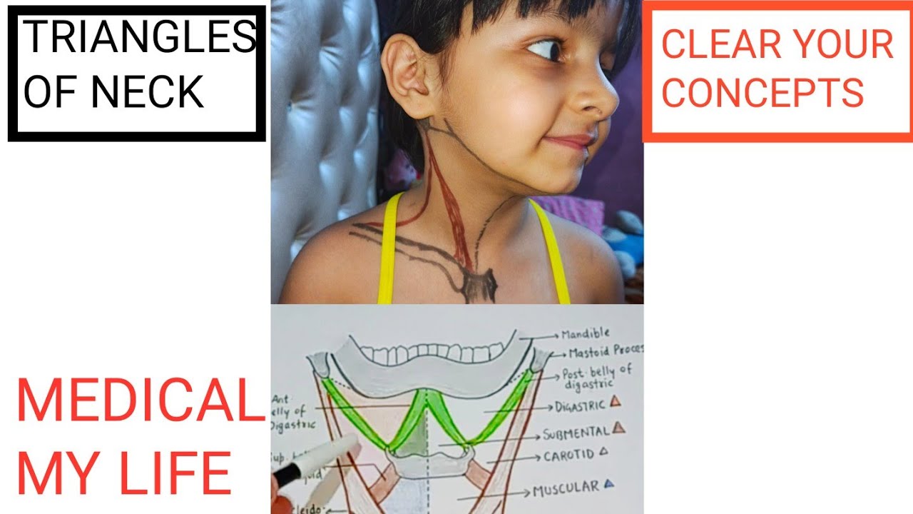 TRIANGLES OF NECK