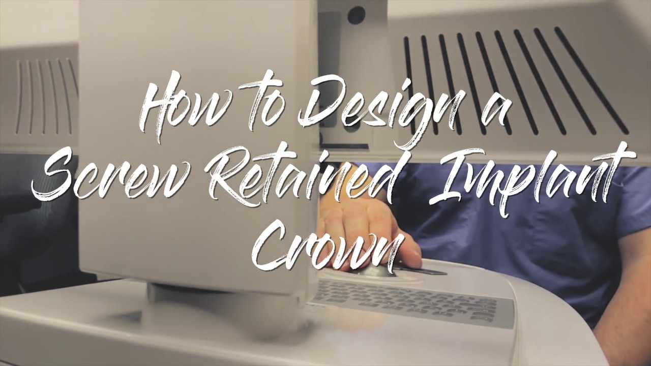 Advanced CADCAM - How to Scan and Design a Screw Retained Crown compress
