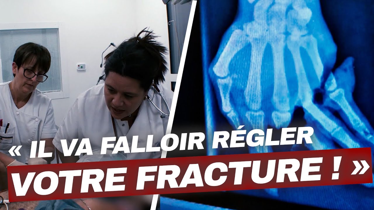 Plus de 10h d’opération complexe pour rattacher les 3 doigts de ce patient 😮 | Enquête Choc