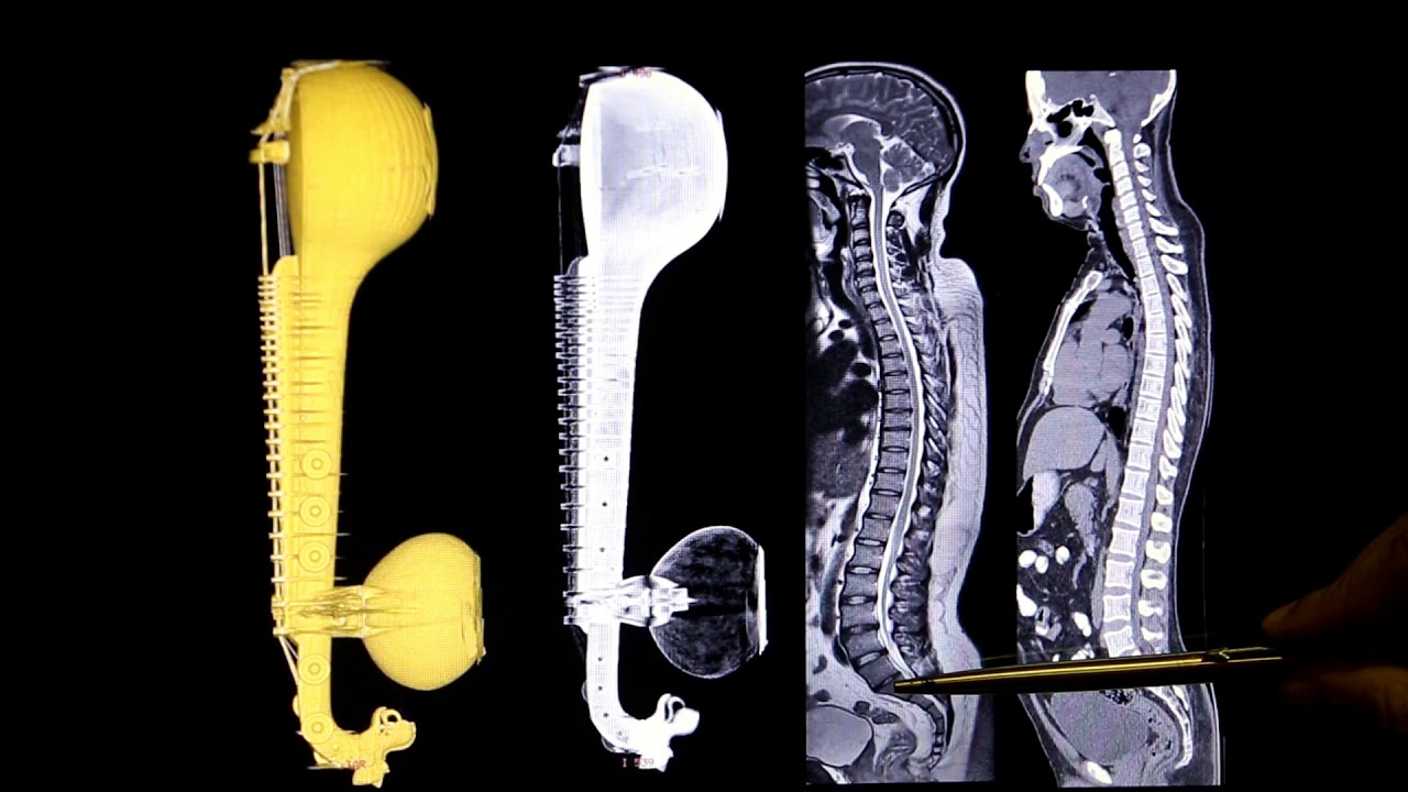 Human resemblance to Veena instrument- Imaging perspective By Dr Durga Prasad (Radiologist)