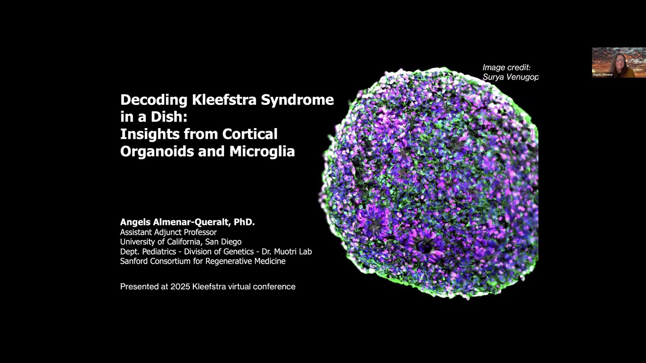 Decoding Kleefstra Syndrome in a Dish: Insights from Cortical Organoids and Microglia